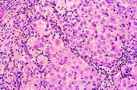  Out, damn'd spot! out, I say!Shakespeare (Macbeth)